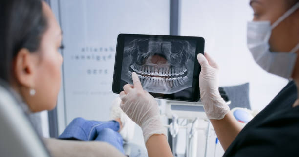 Licensed Tooth Extraction service in San Antonio, TX - Smile Center Dentistry